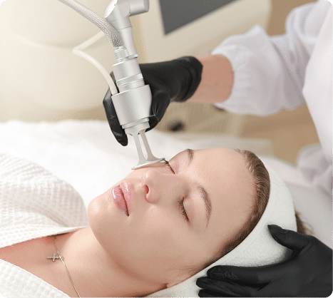 Laser Skin Resurfacing